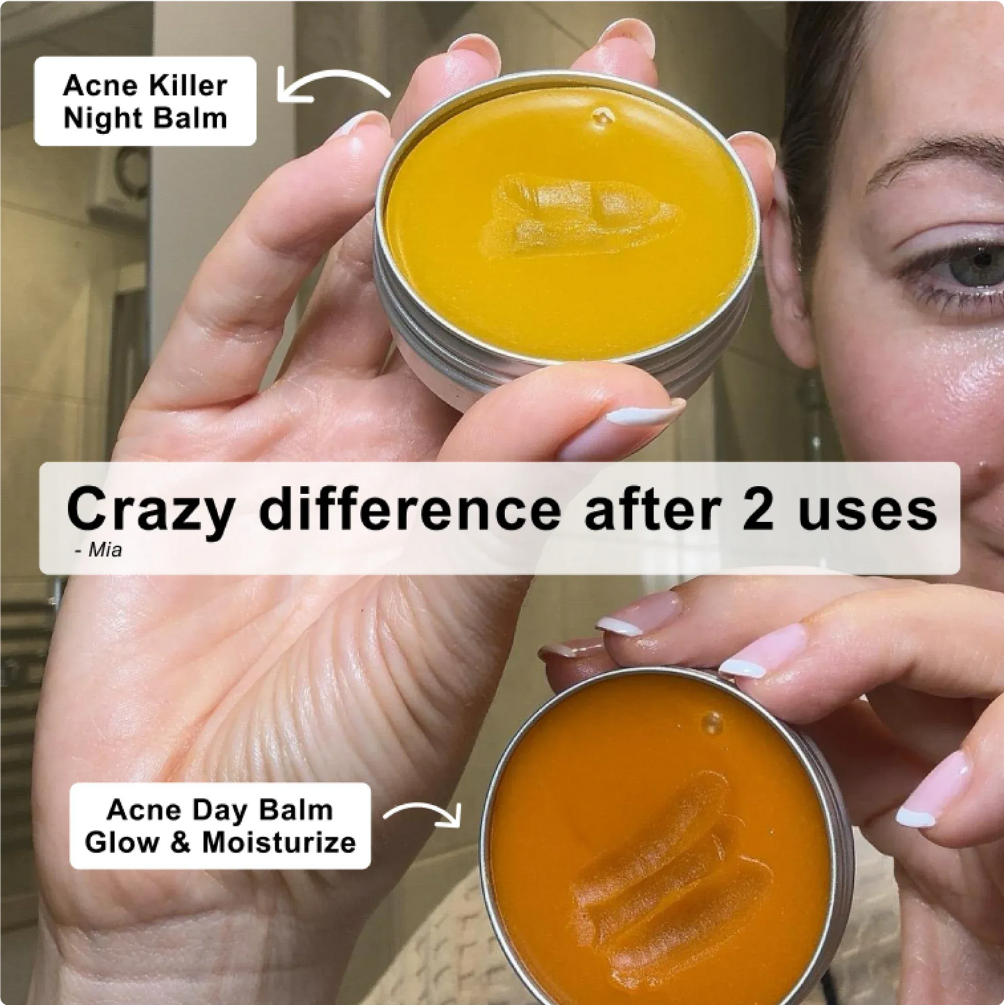 Breakout & Redness Ritual