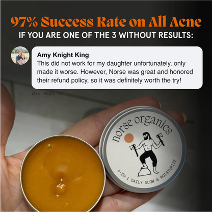 Breakout & Redness Ritual