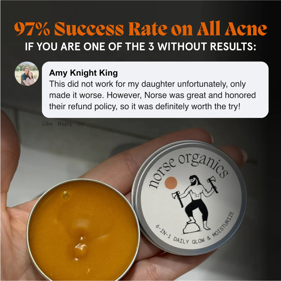 Breakout & Redness Ritual