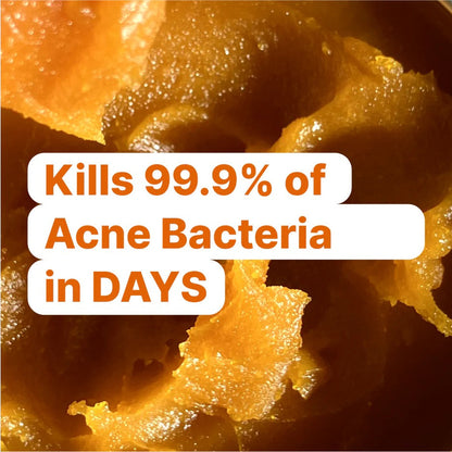 Breakout & Redness Ritual