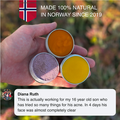 Breakout & Redness Ritual