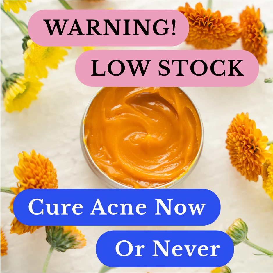 Breakout & Redness Ritual